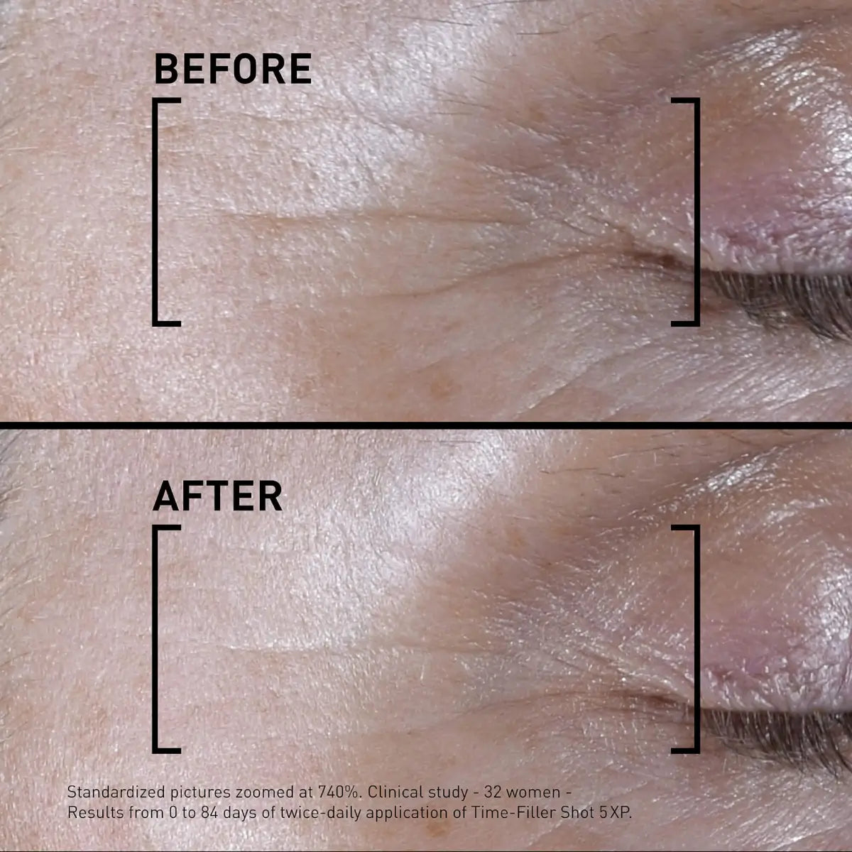 Filorga Time-Filler Shot 5XP sérum concentrado de 15 ml em frasco preto com aplicador de precisão.