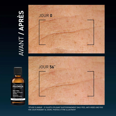 Filorga NCEF-Revitalize Sérum antienvelhecimento de 30 ml em frasco com doseador prateado e base rosa translúcida.